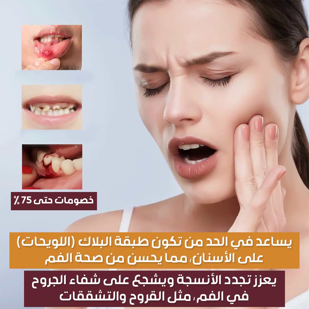 Mouth Relief Spray 2